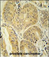 Rabbit Polyclonal Antibody to ENAM