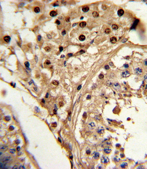 Rabbit Polyclonal Antibody to KLF6