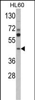 Rabbit Polyclonal Antibody to MVD