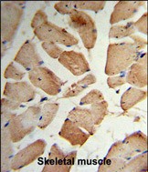 Rabbit Polyclonal Antibody to MVD