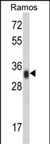 Rabbit Polyclonal Antibody to HLA-DRA (N-term)