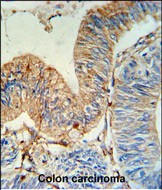 Rabbit Polyclonal Antibody to HLA-DRA (N-term)