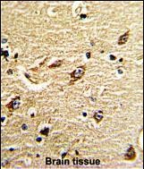 Rabbit Polyclonal Antibody to ND5