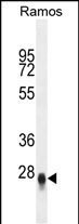 Rabbit Polyclonal Antibody to CRIP3