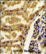 Rabbit Polyclonal Antibody to CRIP3