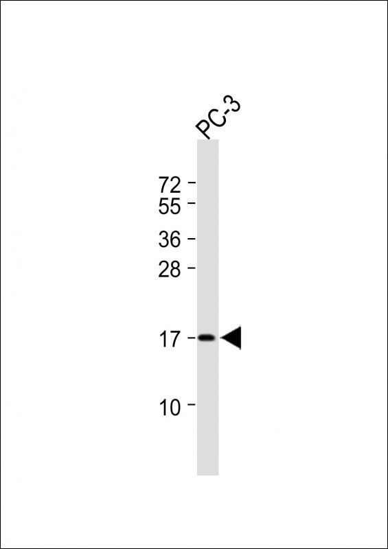 CCDC58 (N-term)