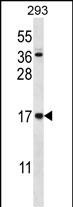 Rabbit Polyclonal Antibody to CCDC58 (N-term)