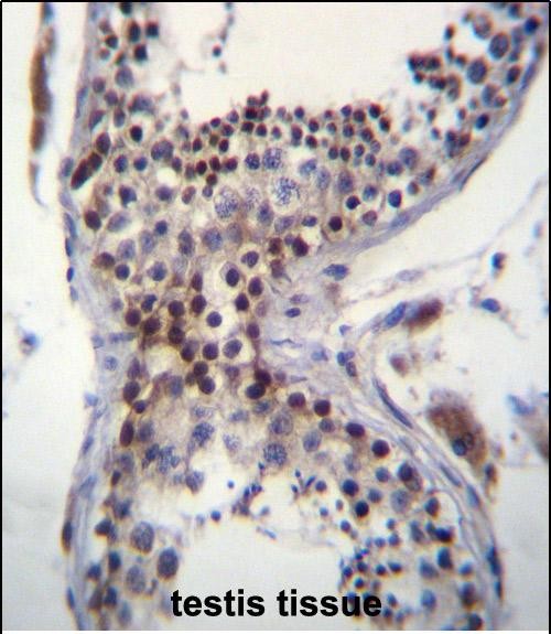 Rabbit Polyclonal Antibody to CCDC58 (N-term)