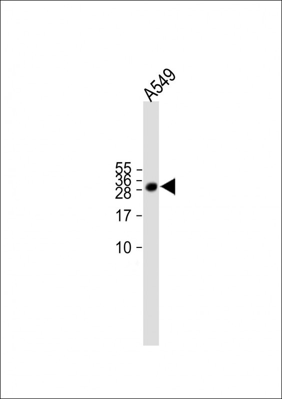 Rabbit Polyclonal Antibody to C17orf95