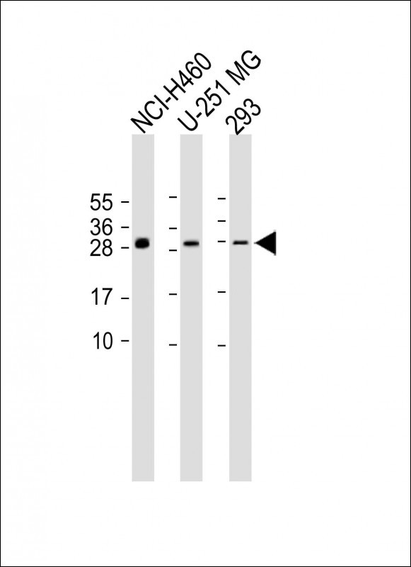 Rabbit Polyclonal Antibody to C17orf95