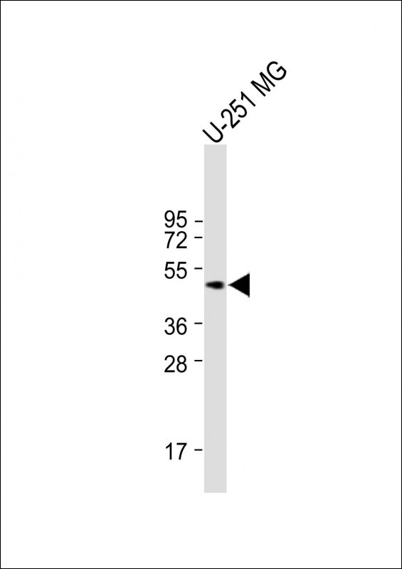 Mouse Mapkapk5 (N-term)