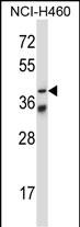 Rabbit Polyclonal Antibody to Mouse Mapkapk5 (N-term)
