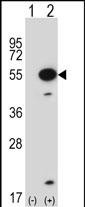 Rabbit Polyclonal Antibody to Mouse Mapkapk5 (N-term)