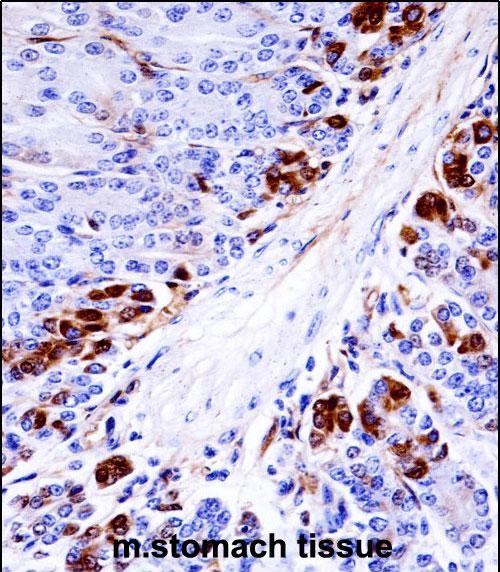 Rabbit Polyclonal Antibody to Mouse Mapkapk5 (N-term)