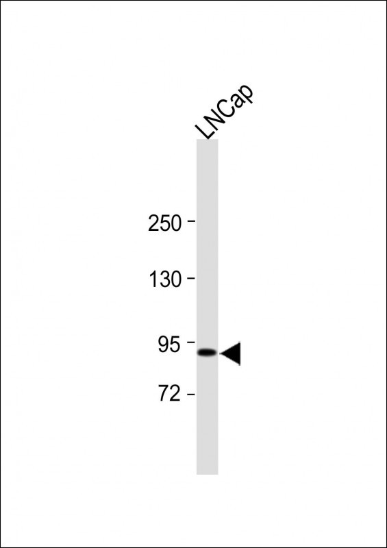 TRPV6