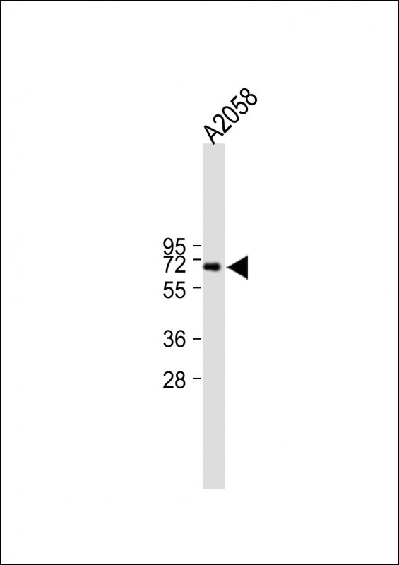RORA (T216)