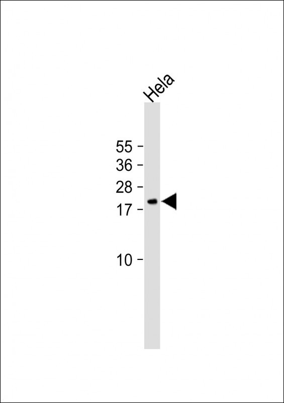 NDUFAB1