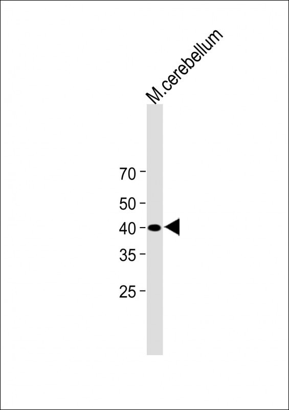 LRTM2