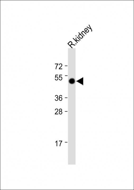 Mouse Pnpla3