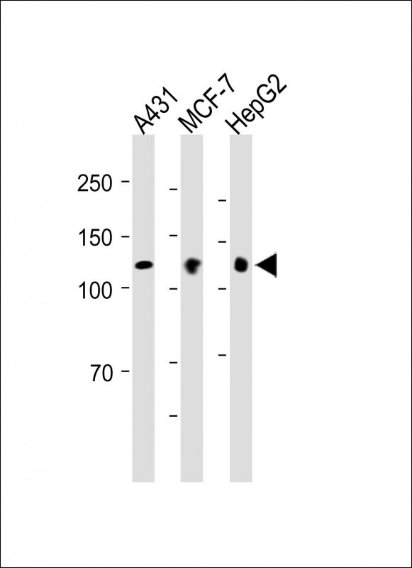 BMPR2 (N-term)