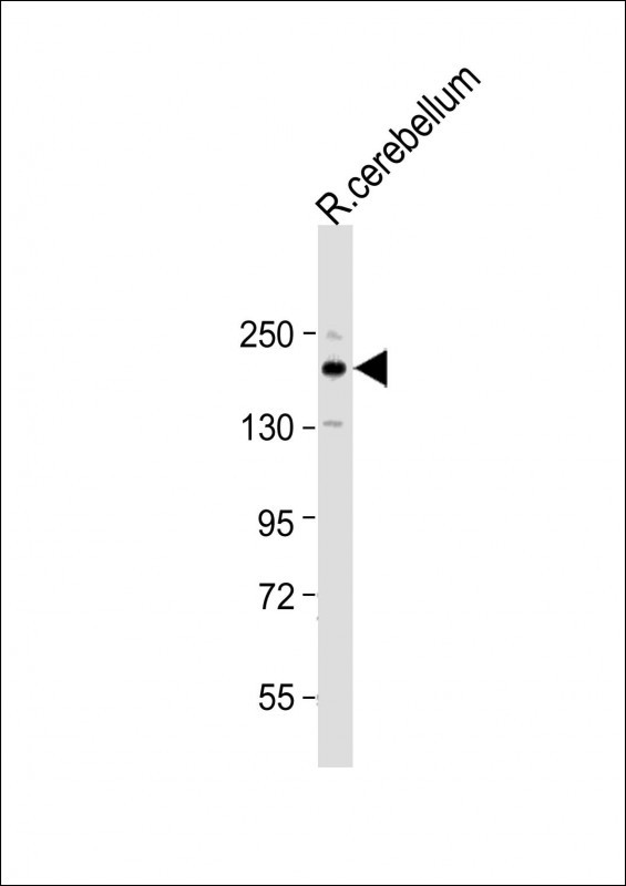 RET (C-term L1027)
