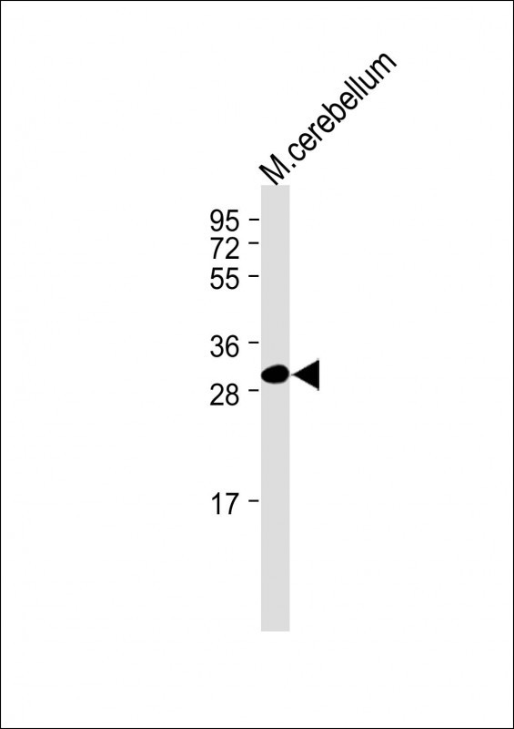 TMEM66 (N-term)