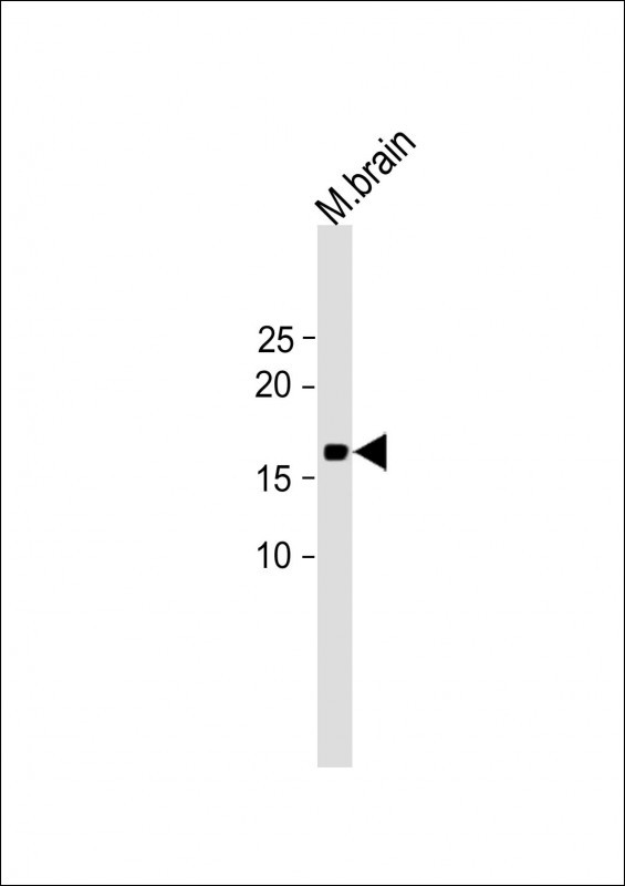 HIST3H2A (N-term)