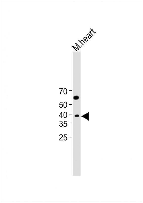 CH25H (N-Term)