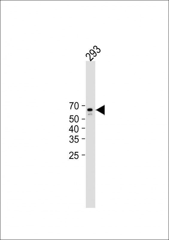 CAMK2A (CAMK2 alpha)