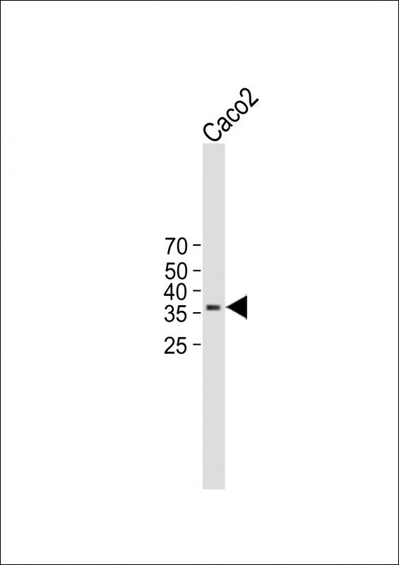 TMEM150B (N-term)