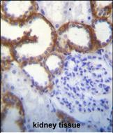 Rabbit Polyclonal Antibody to TMEM150B (N-term)