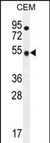 Rabbit Polyclonal Antibody to TBC1D13