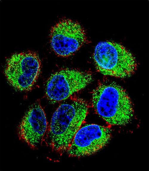 Rabbit Polyclonal Antibody to TBC1D13