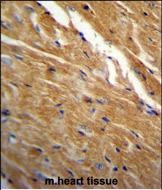 Rabbit Polyclonal Antibody to TBC1D13