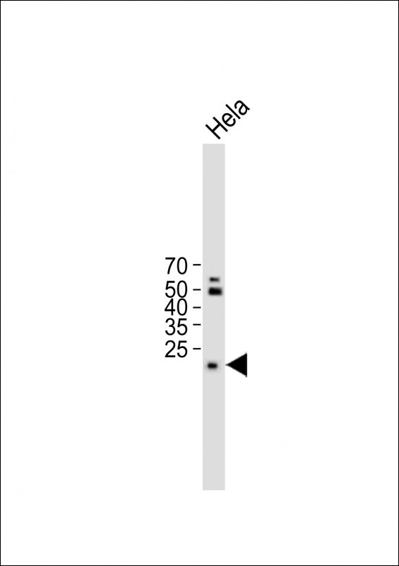 TM4SF1 (N-term)