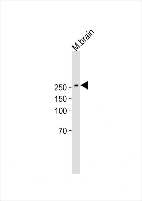 SPTBN1
