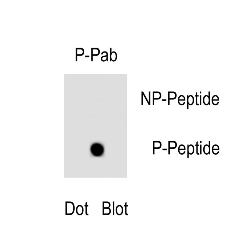 Phospho-FAS(Y291)