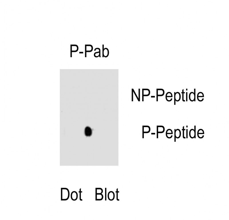 Phospho-RUNX2(S465)