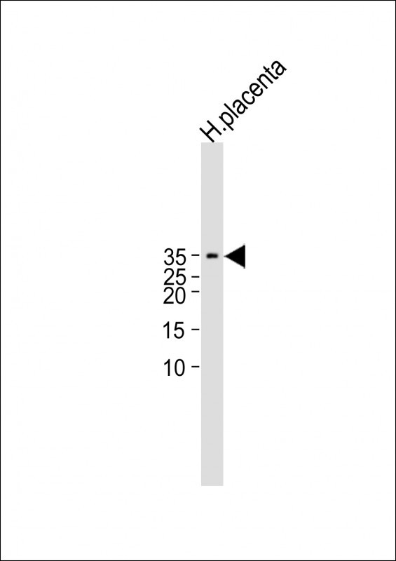 Rabbit Polyclonal Antibody to CGB/HCG-Beta