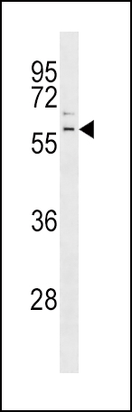 Rabbit Polyclonal Antibody to Parkin