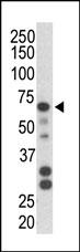 Rabbit Polyclonal Antibody to Parkin