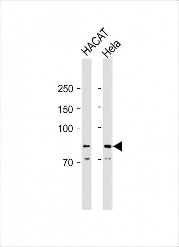 ALOX12B