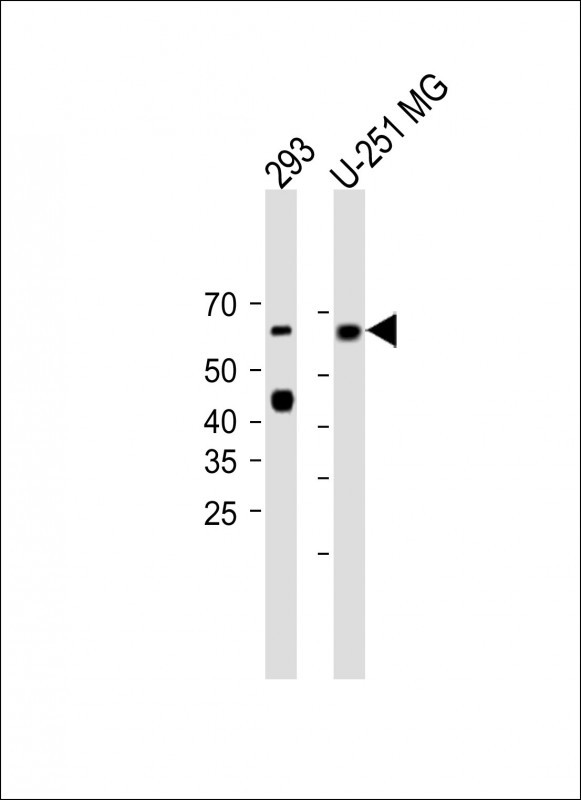 MCOLN1