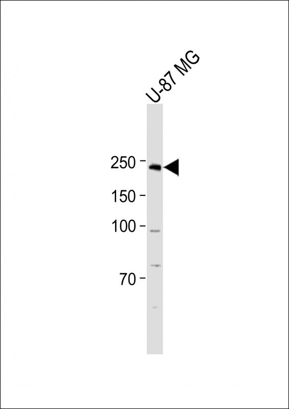 DEPD5  (C-term)