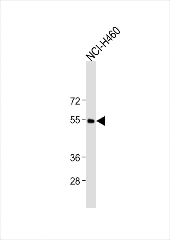 CXCR4(N-term)