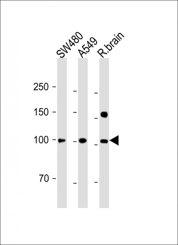 ANO6 (N-term)