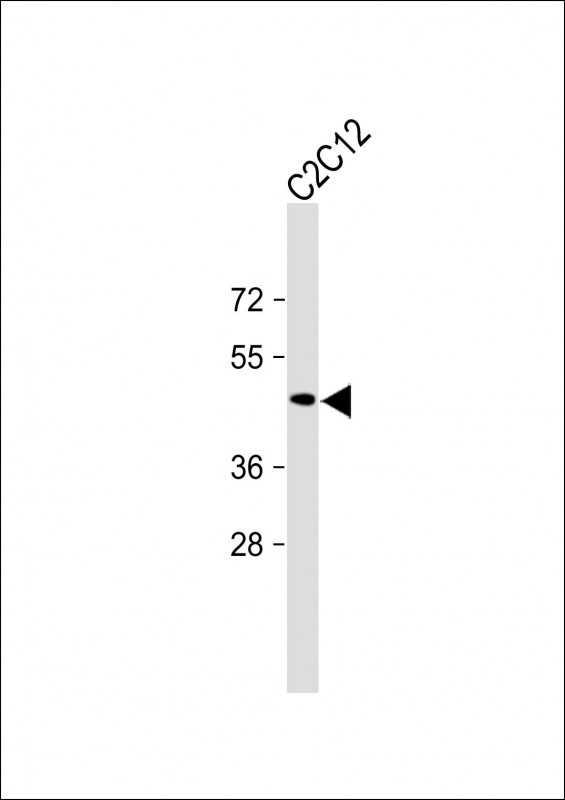 PD L1