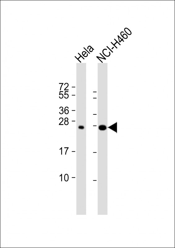 Rabbit Polyclonal Antibody to IL6