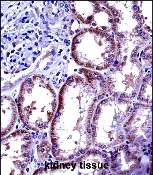 Rabbit Polyclonal Antibody to IL6