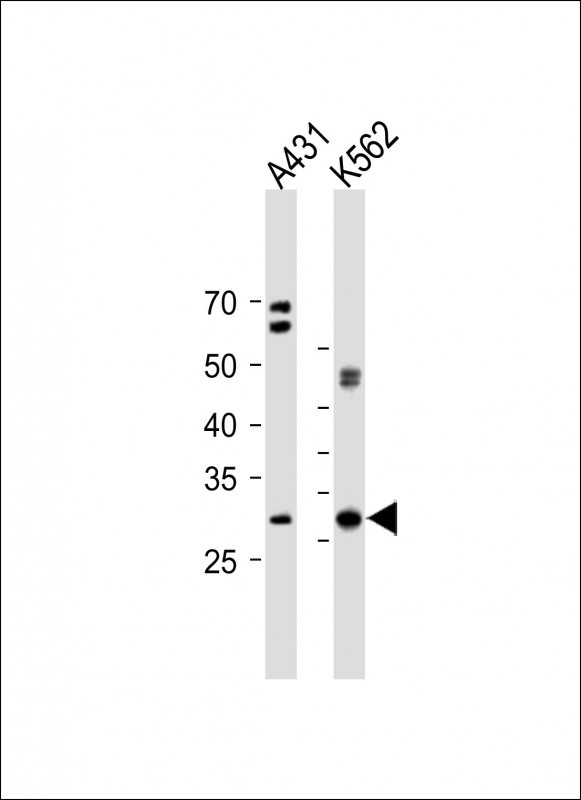 VCX3A (N-term)
